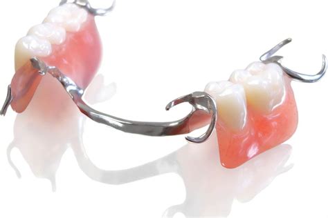 cost of partial dental plates in costa rica  All-on-4s, a type of implant-supported dentures, cost around $15,000 per arch